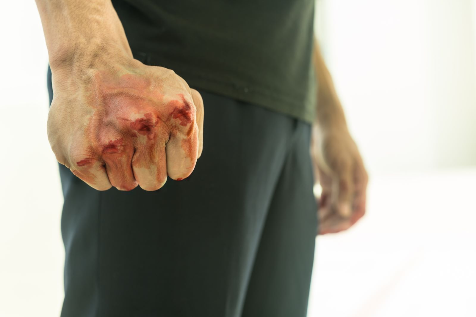 Kansas City MO Assault Defense Lawyer | Experienced Legal Defense